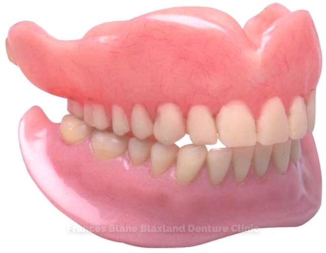 complete-or-full-dentures